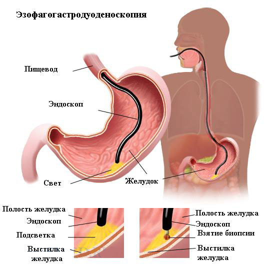 ЕГДС